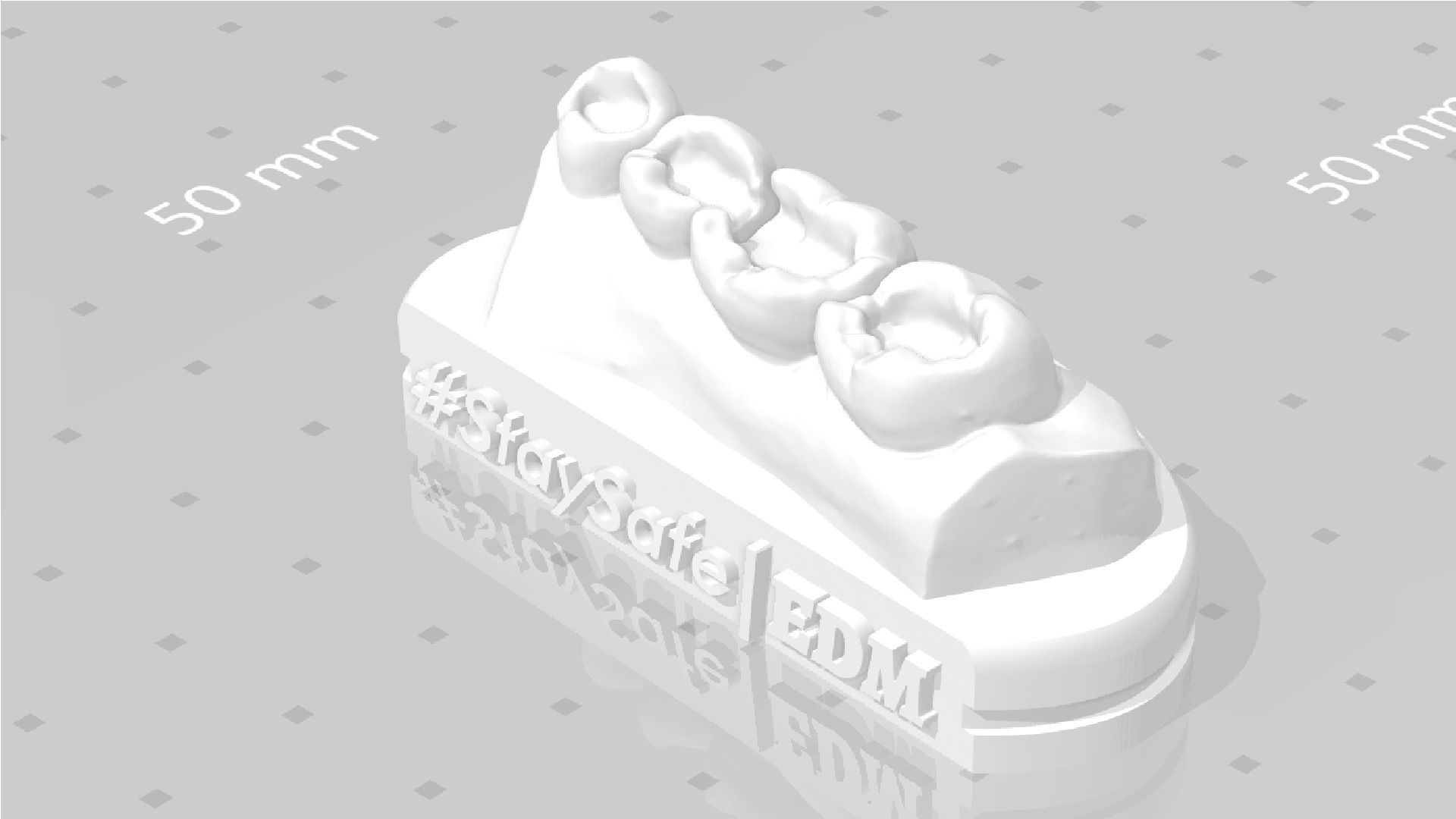 EDM Dental Practice Exclusive Model Lower Class 1 and 2 3D print model_3