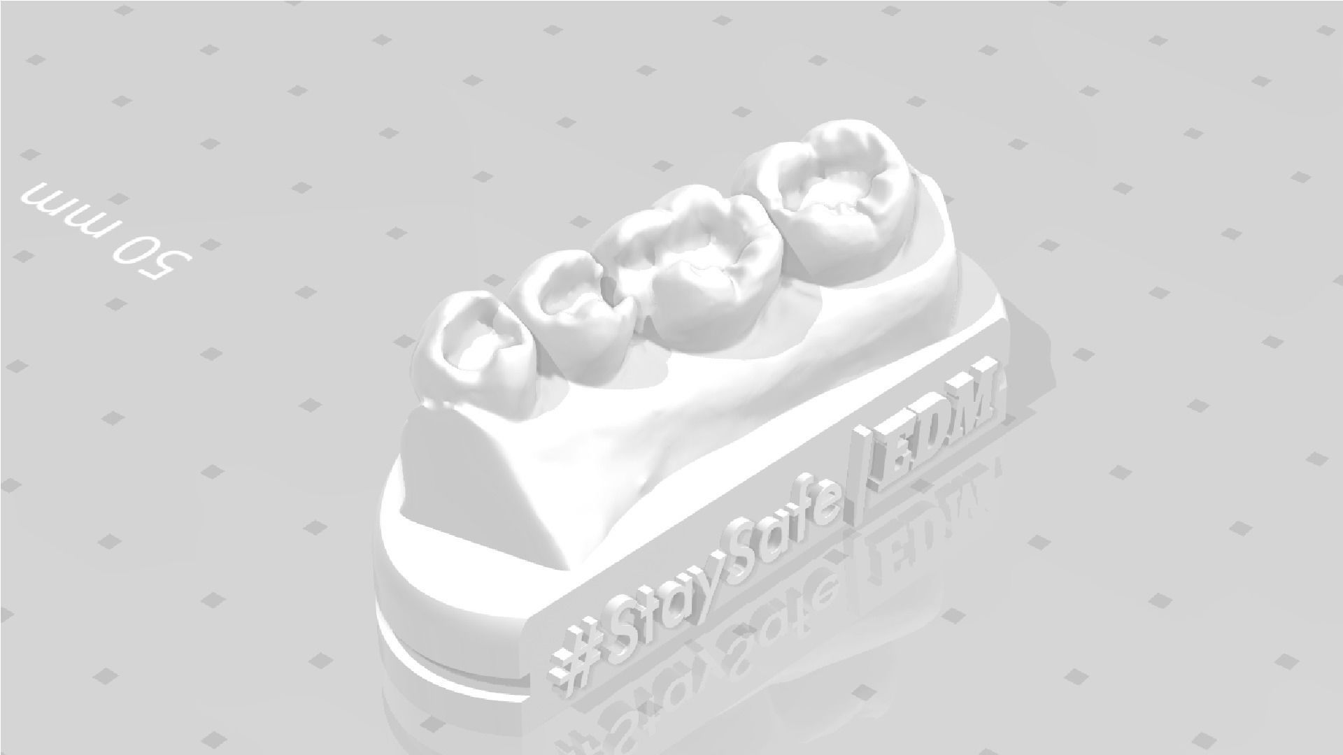 EDM Dental Practice Exclusive Model Lower Class 1 and 2 3D print model_4