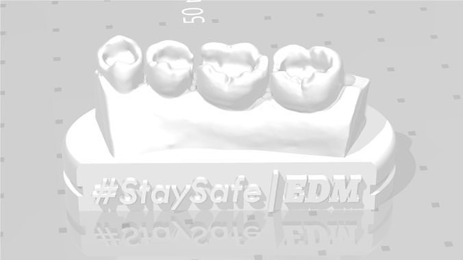 EDM Dental Practice Exclusive Model Lower Class 1 and 2 3D print model