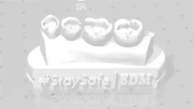 EDM Dental Practice Exclusive Model Lower Class 1 and 2 3D print model
