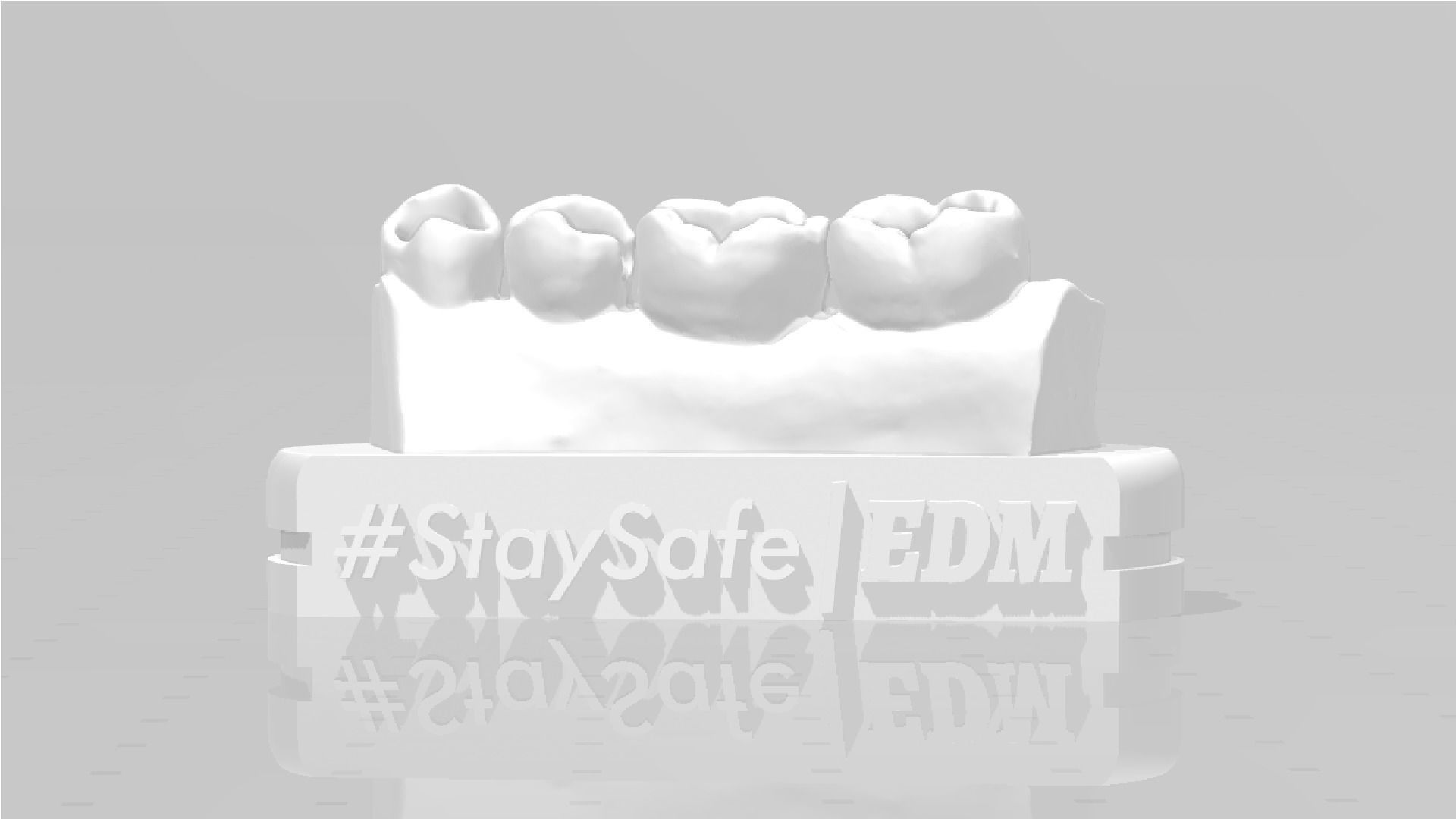 EDM Dental Practice Exclusive Model Lower Class 1 and 2 3D print model_1