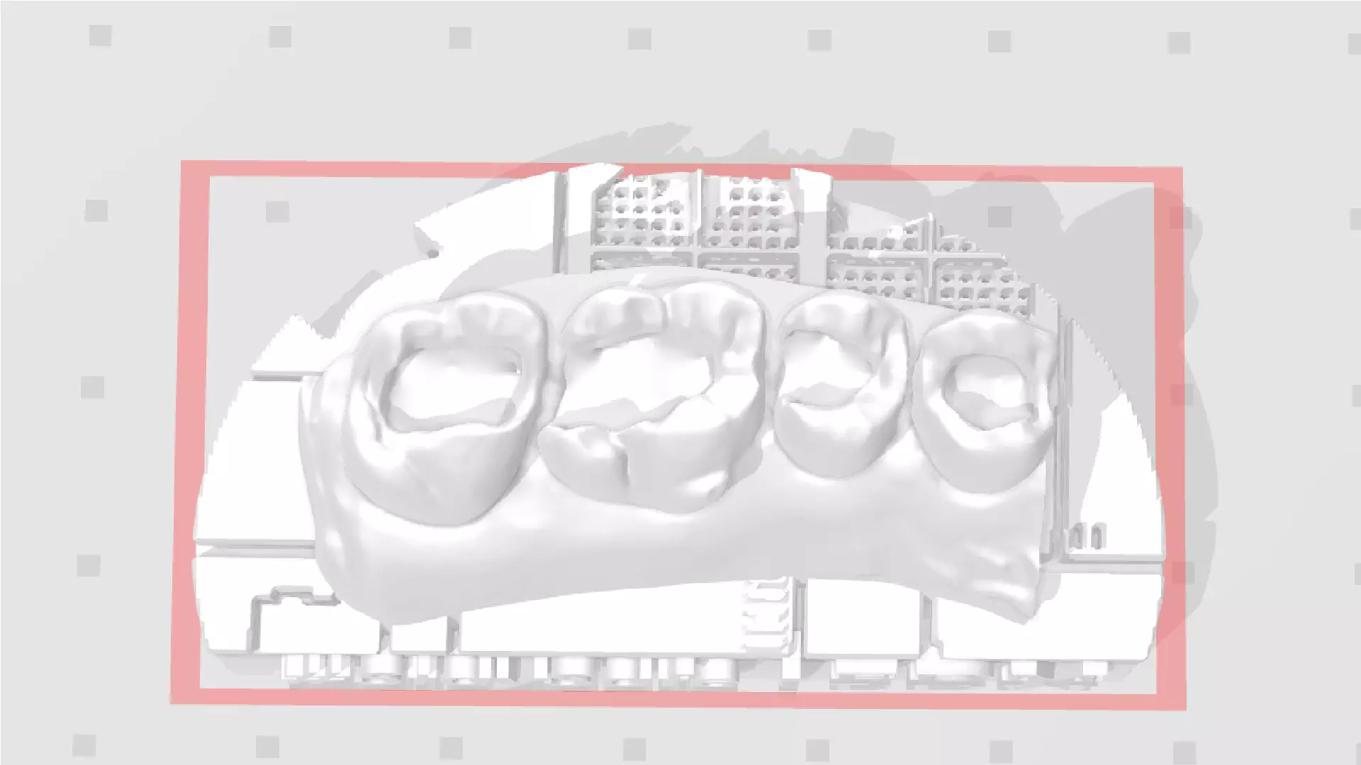 EDM Dental Practice Exclusive Model Upper Class 1 and 2 3D print model_0