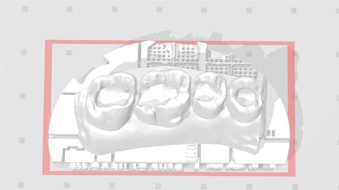 EDM Dental Practice Exclusive Model Upper Class 1 and 2 3D print model