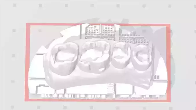 EDM Dental Practice Exclusive Model Upper Class 1 and 2 3D print model
