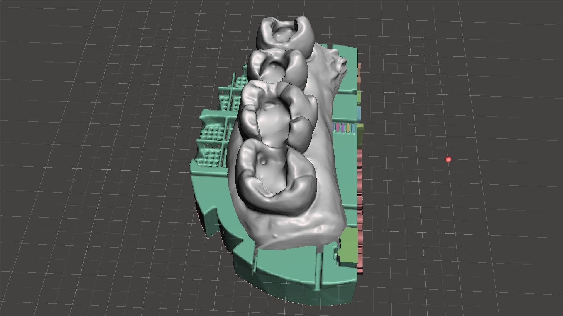EDM Dental Practice Exclusive Model Upper Class 1 and 2 3D print model_6
