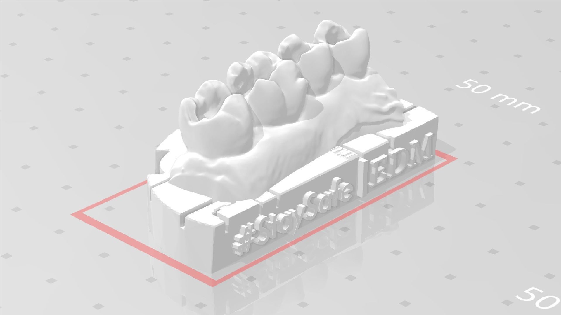 EDM Dental Practice Exclusive Model Upper Class 1 and 2 3D print model_2