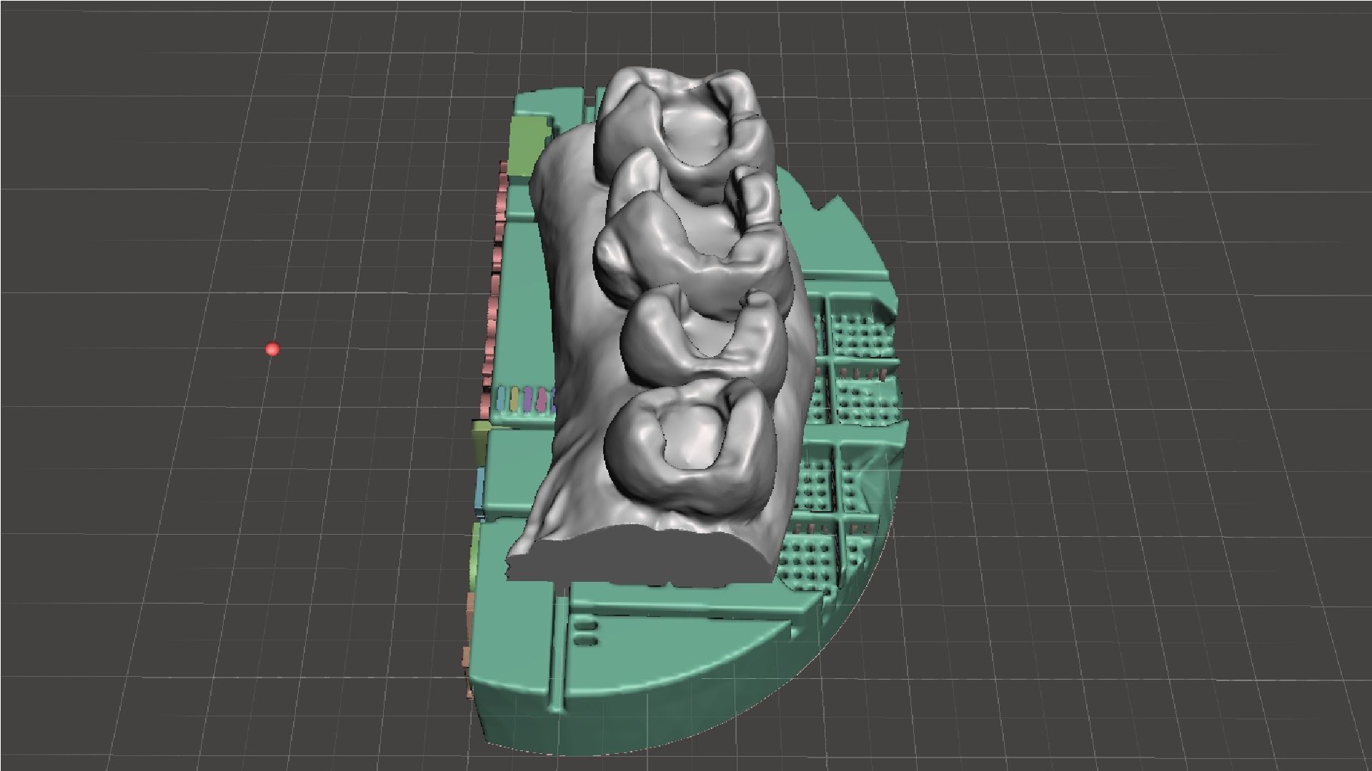 EDM Dental Practice Exclusive Model Upper Class 1 and 2 3D print model_3