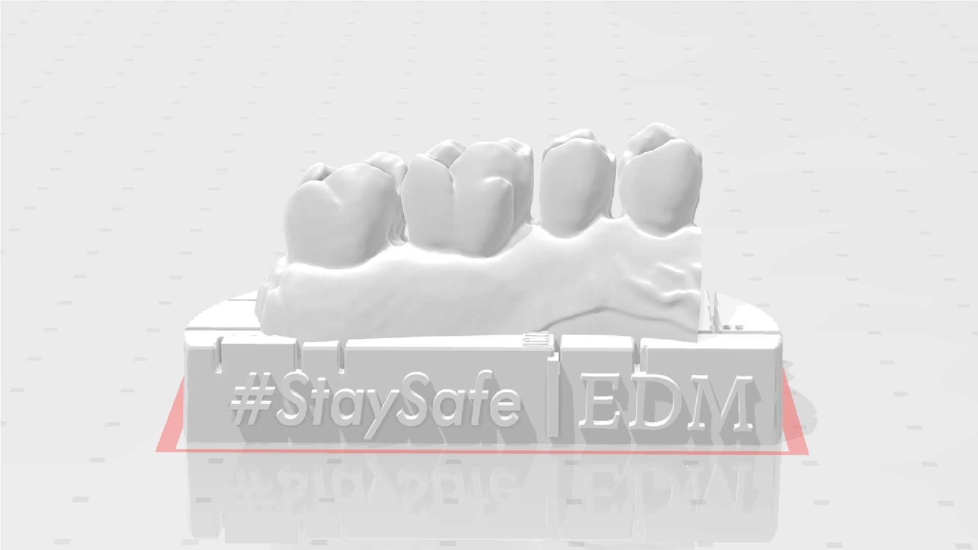 EDM Dental Practice Exclusive Model Upper Class 1 and 2 3D print model_1