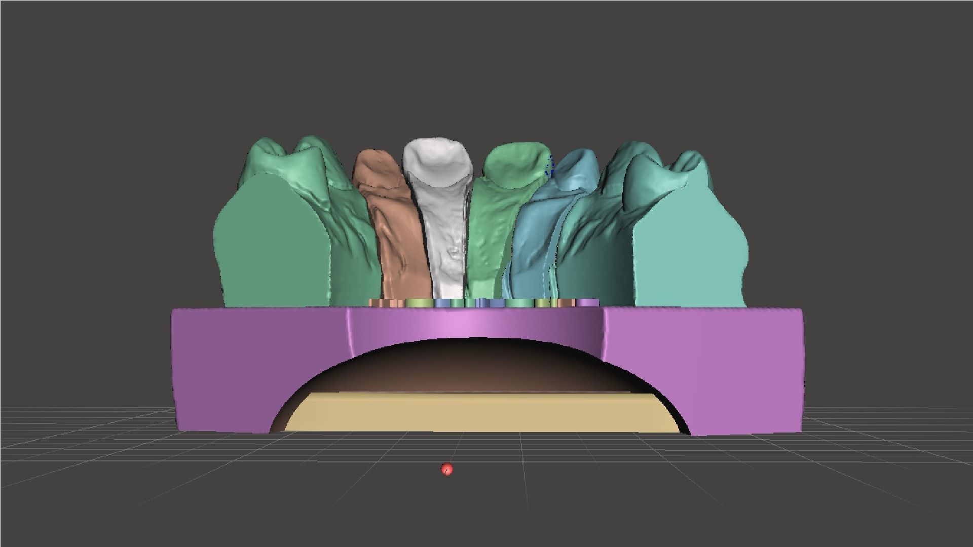 EDM Dental Practice Special Case Die System Veneer 3D print model_2