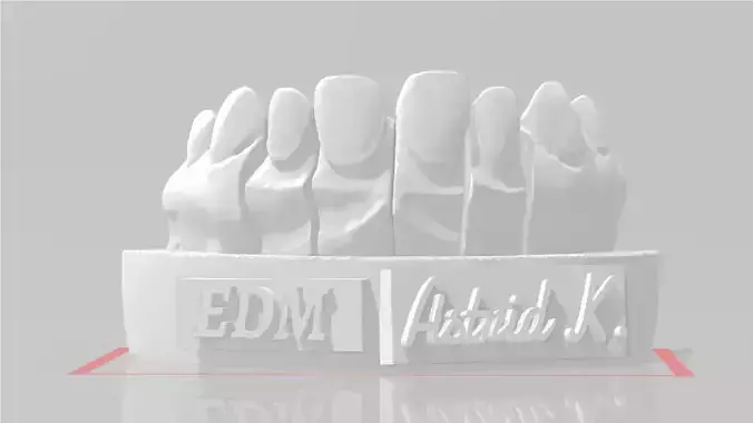 EDM Dental Practice Special Case Die System Veneer 3D print model