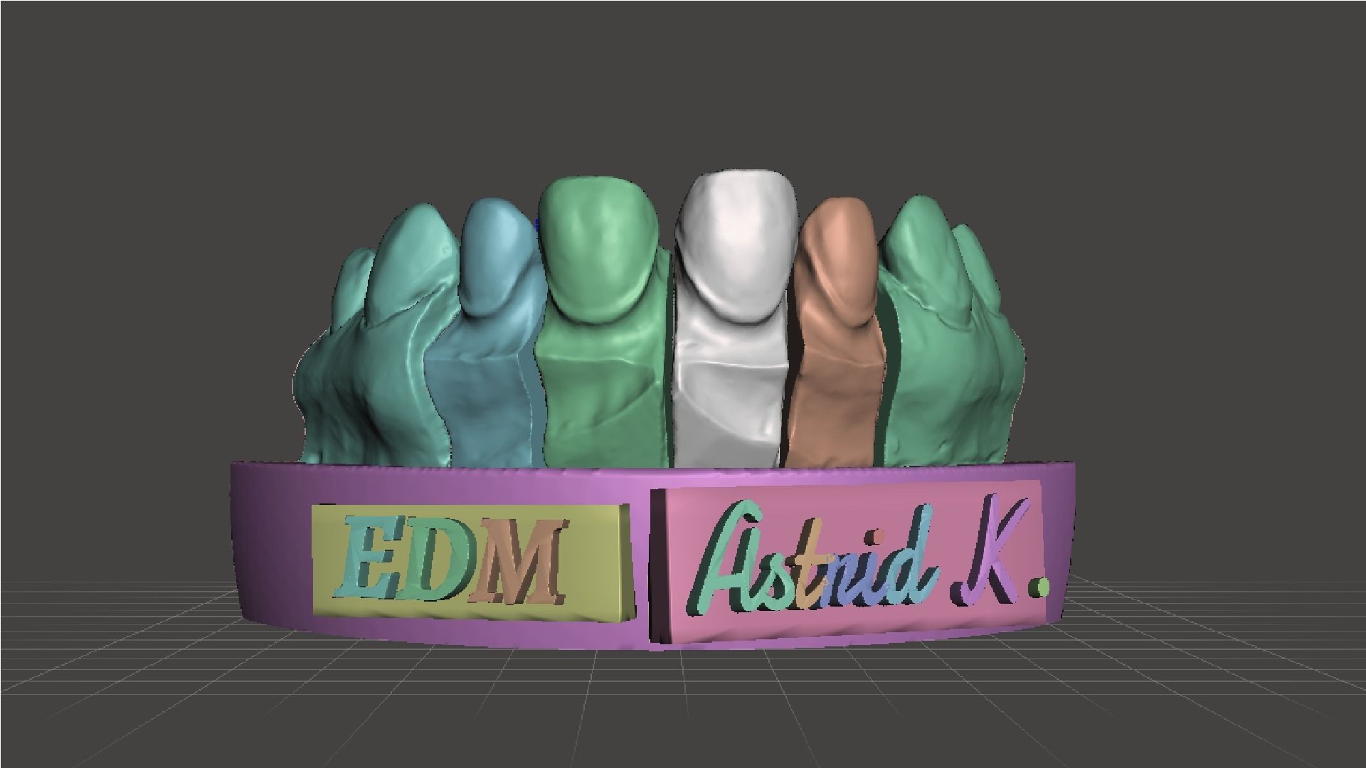 EDM Dental Practice Special Case Die System Veneer 3D print model_3