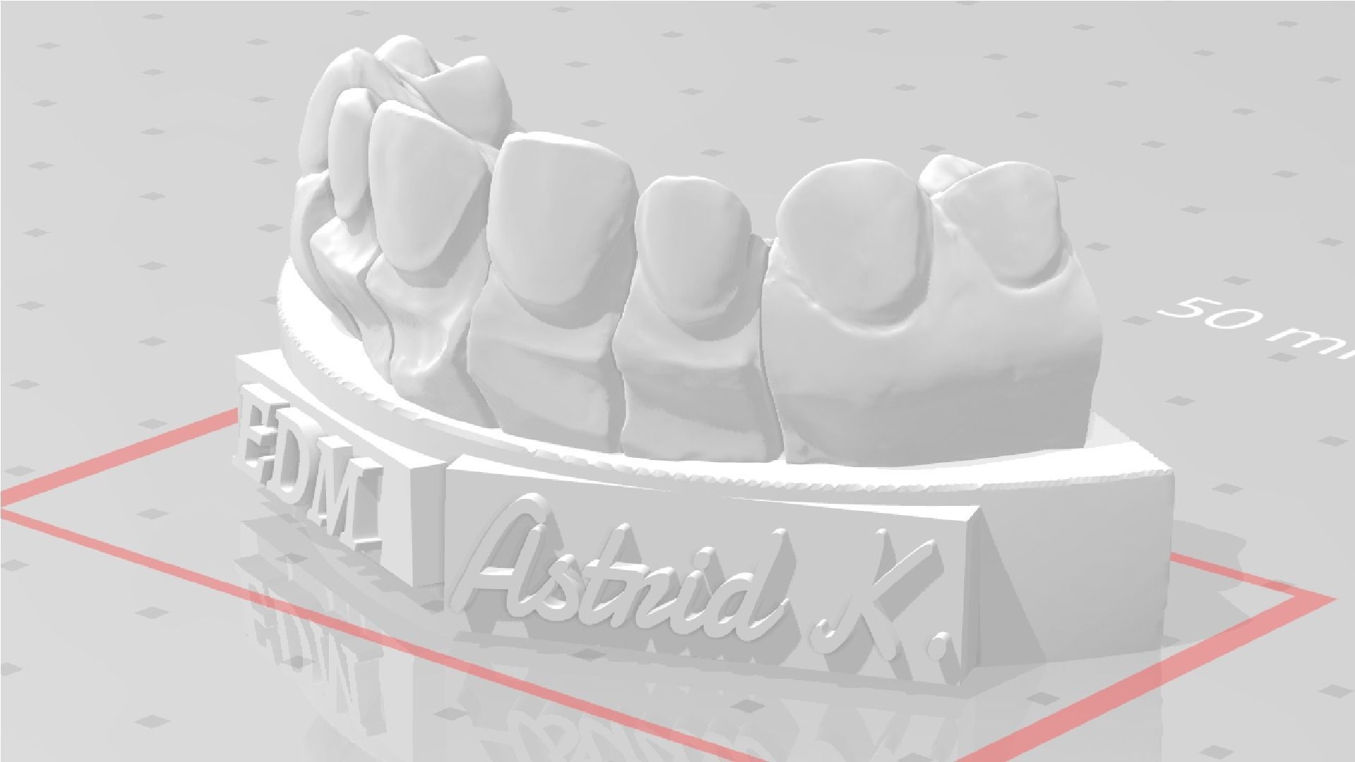 EDM Dental Practice Special Case Die System Veneer 3D print model_5