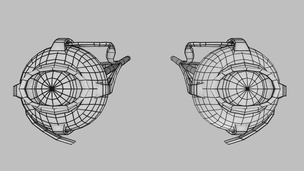 Blowout eye injury and fracture 3D model_55