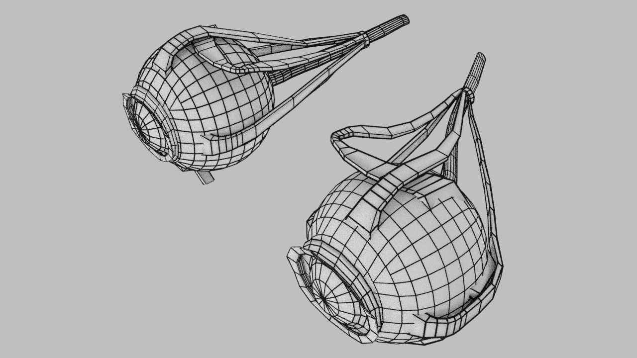 Blowout eye injury and fracture 3D model_53