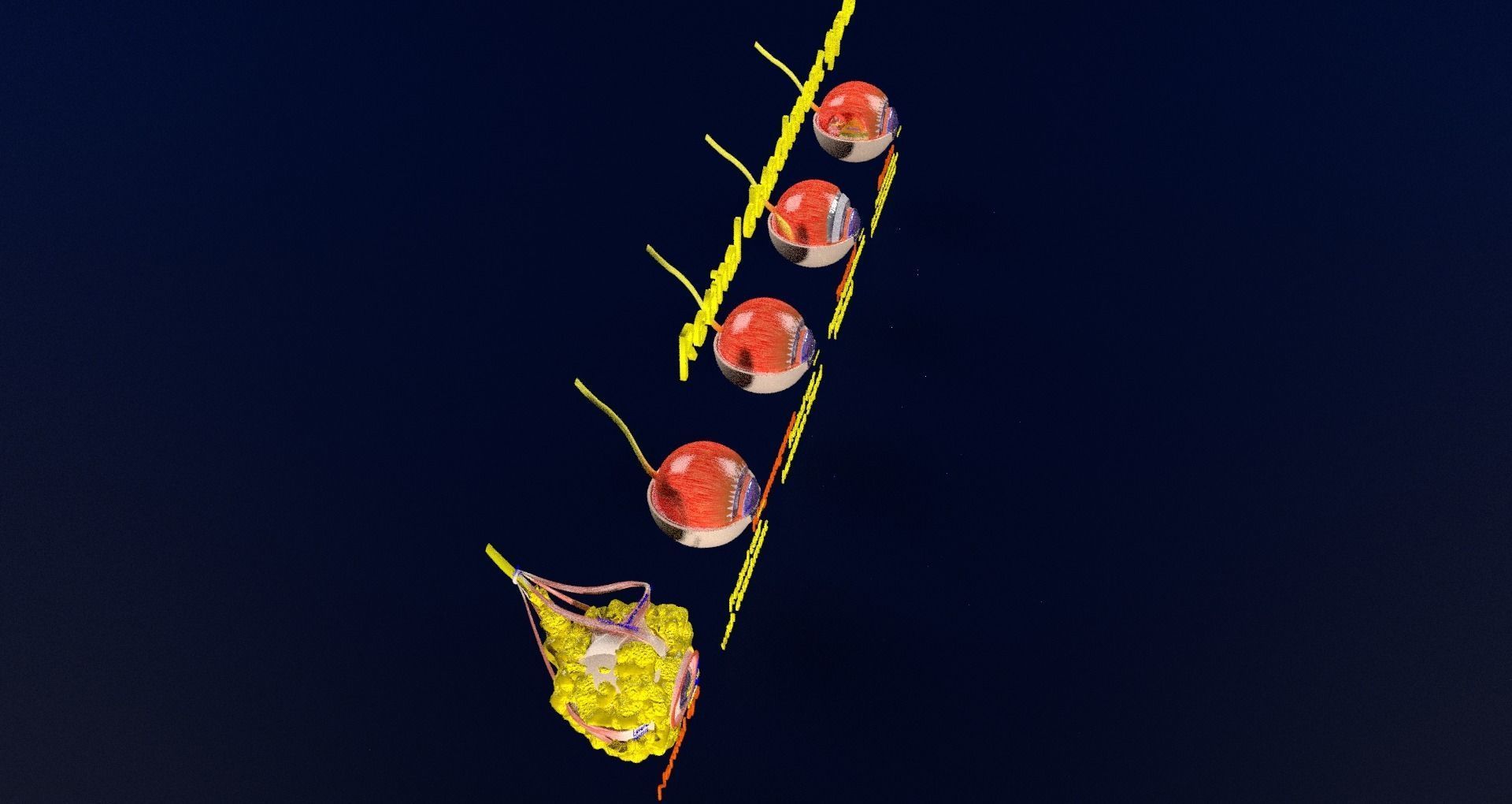 Retinal detachment types eye 3D model_48