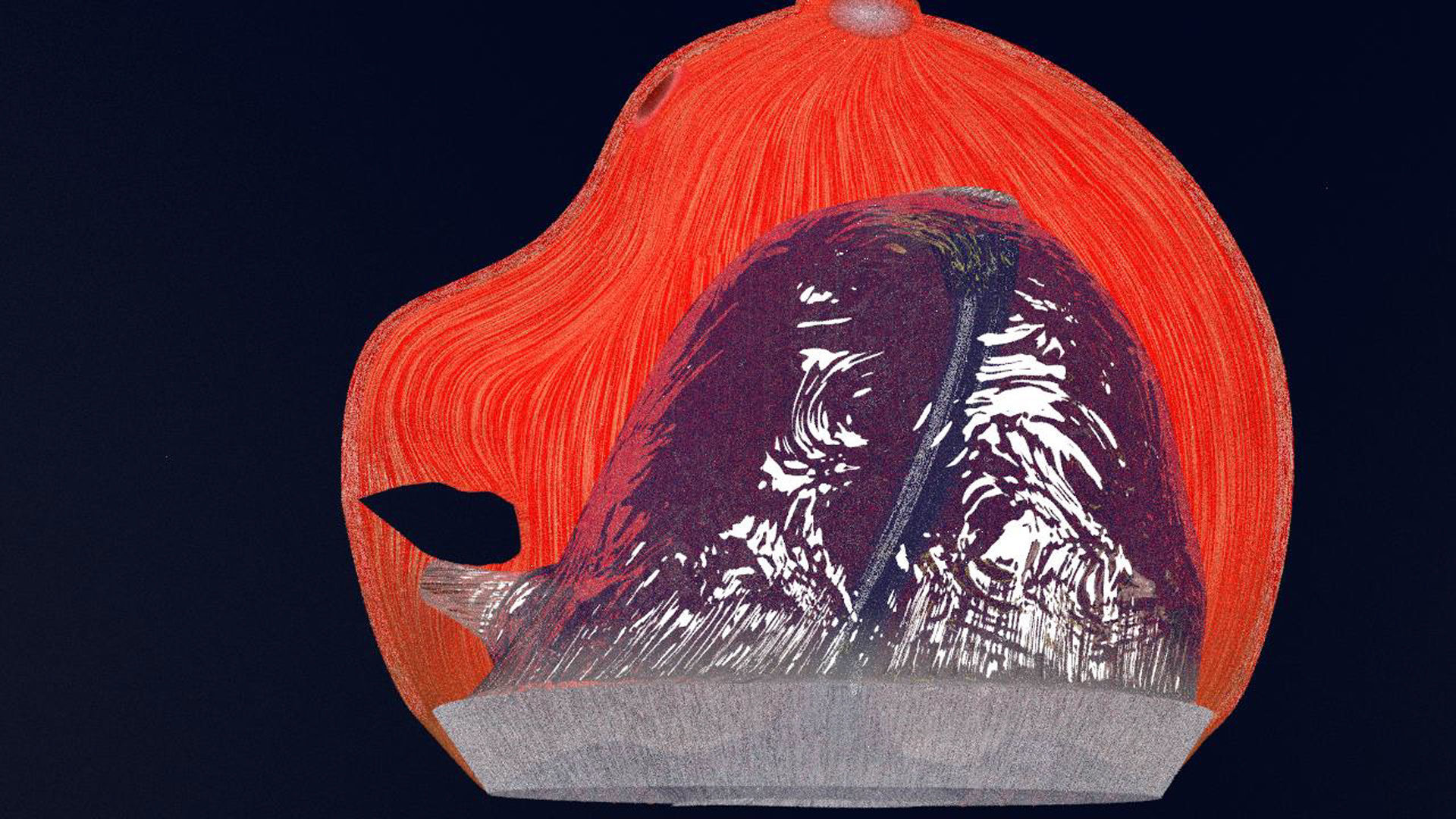 Retinal detachment types eye 3D model_4