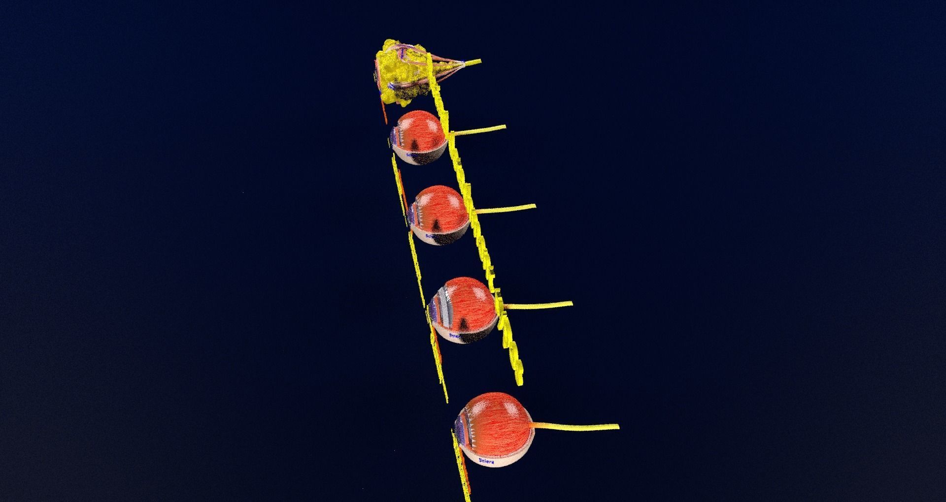 Retinal detachment types eye 3D model_86