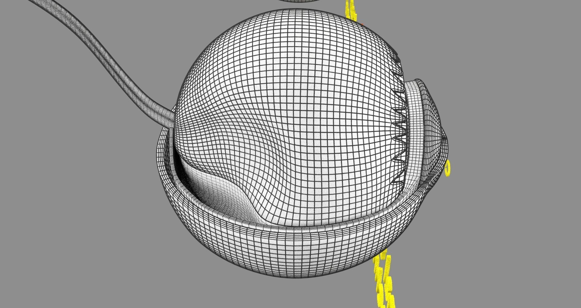 Retinal detachment types eye 3D model_24