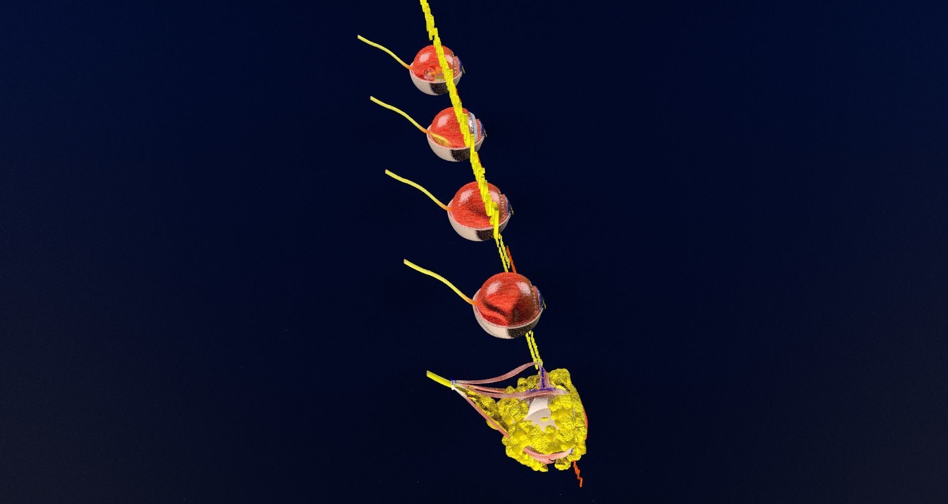 Retinal detachment types eye 3D model_55