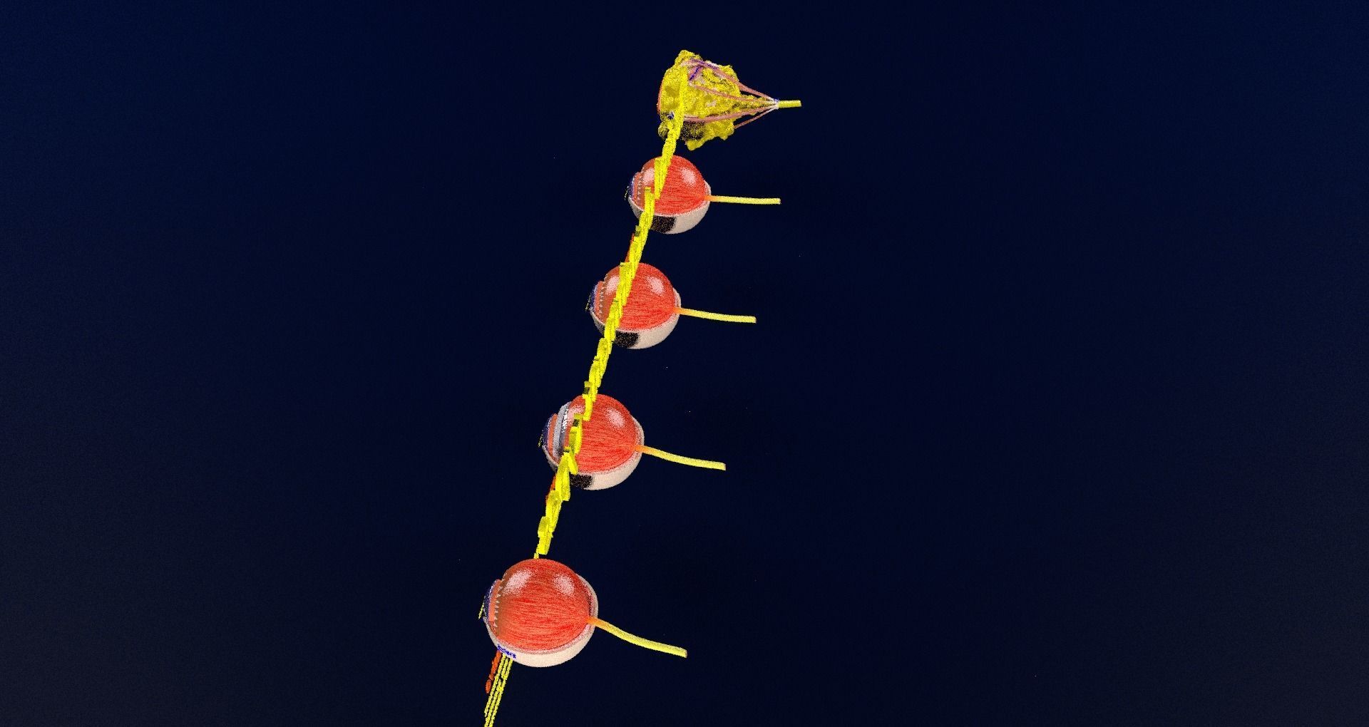 Retinal detachment types eye 3D model_81