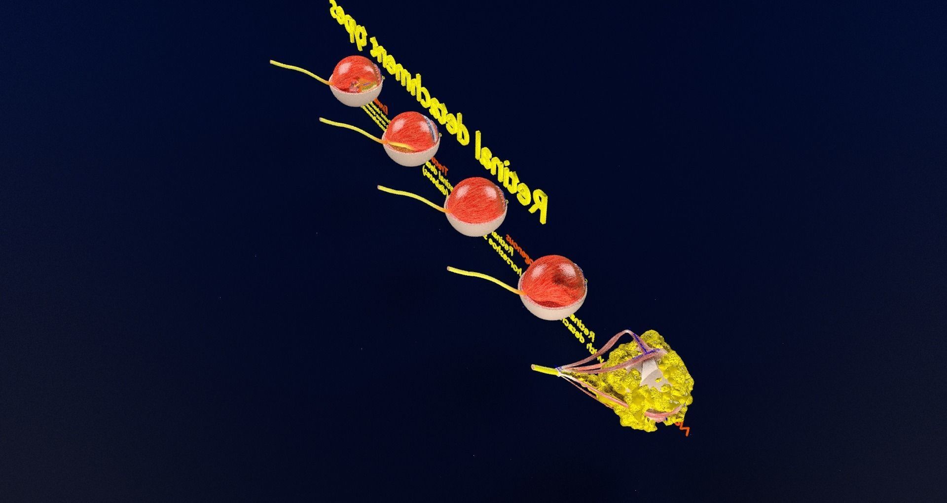 Retinal detachment types eye 3D model_53