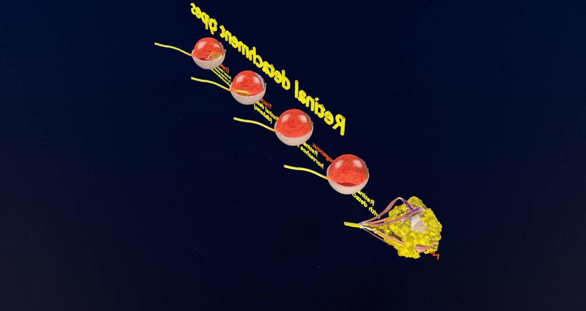 Retinal detachment types eye 3D model_52