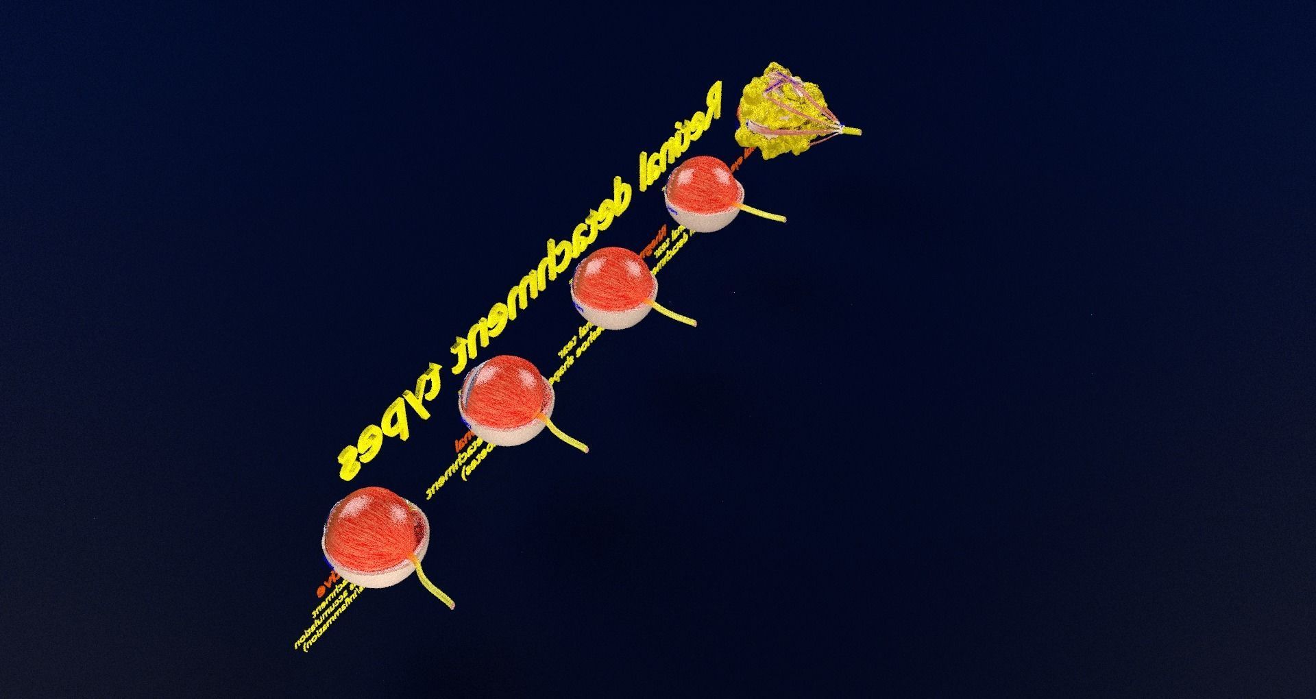 Retinal detachment types eye 3D model_75