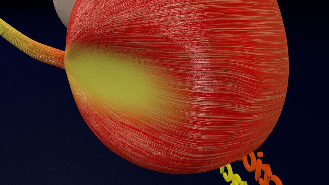 Retinal detachment types eye 3D model_12