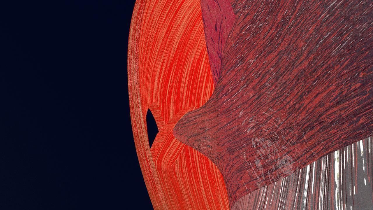 Retinal detachment types eye 3D model_7