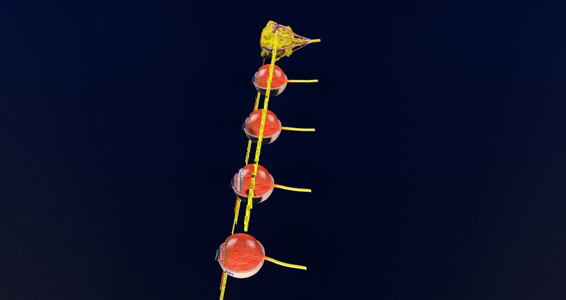 Retinal detachment types eye 3D model_80