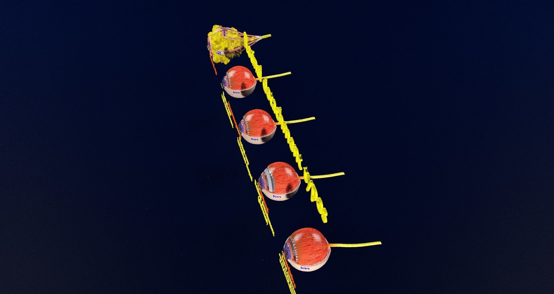 Retinal detachment types eye 3D model_91