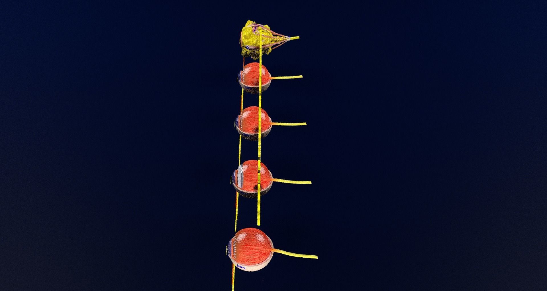 Retinal detachment types eye 3D model_82