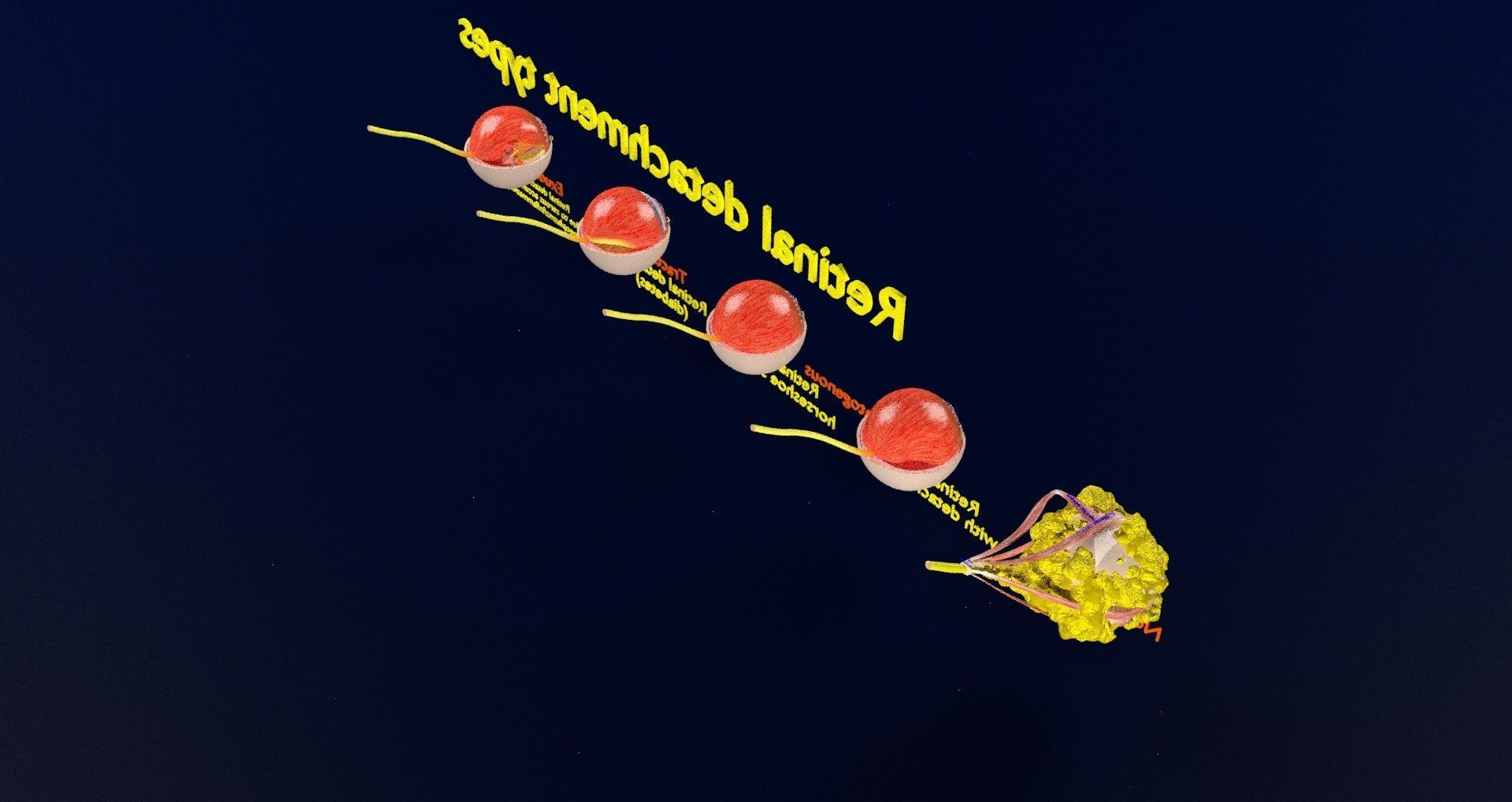 Retinal detachment types eye 3D model_58
