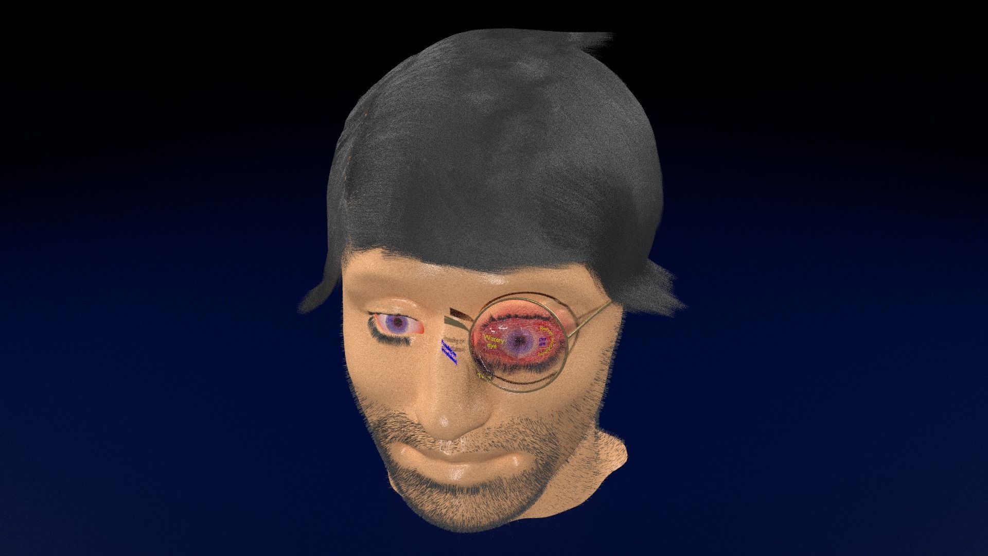 Thyroid eye lesions 3D model_106