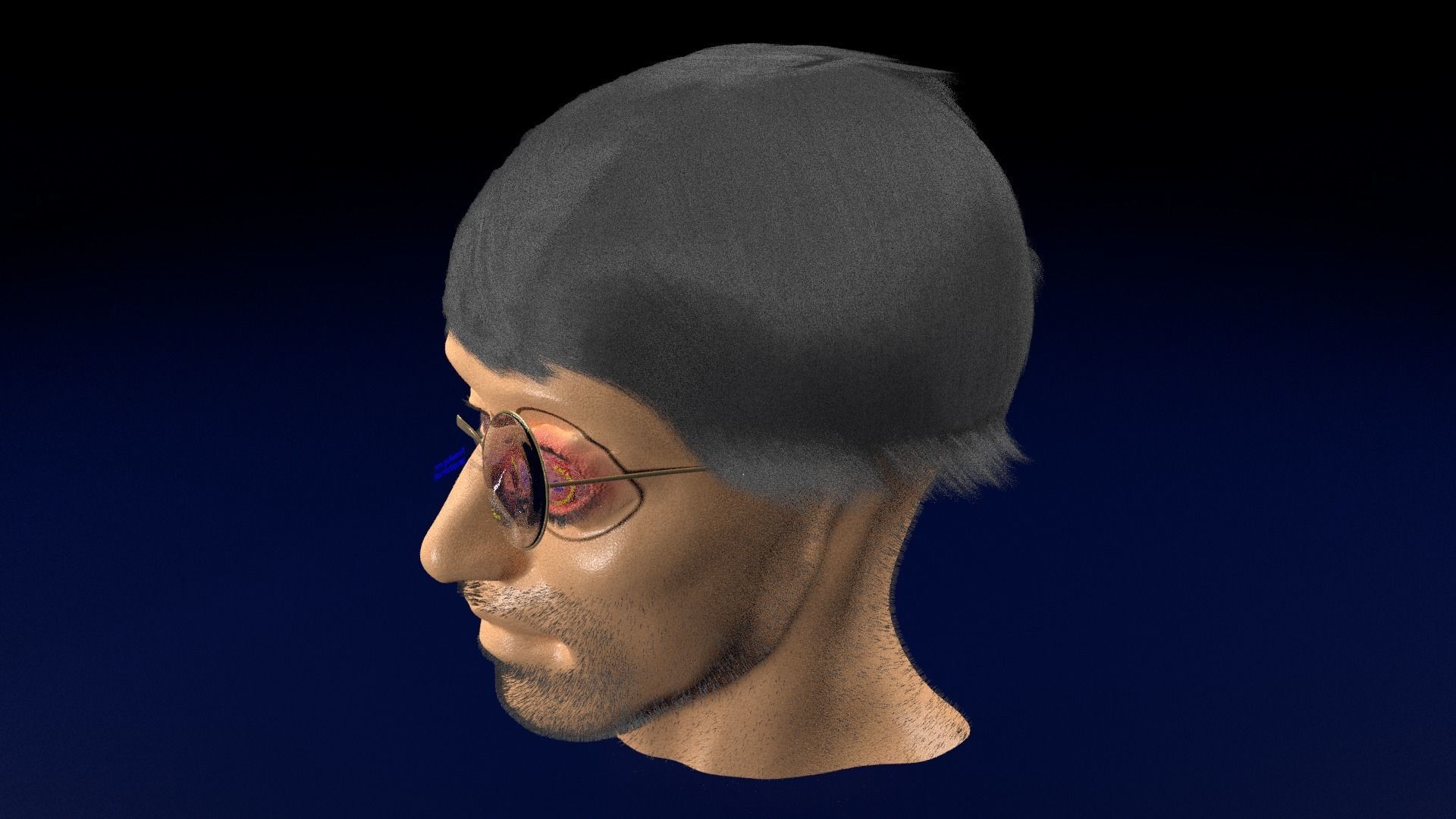 Thyroid eye lesions 3D model_65