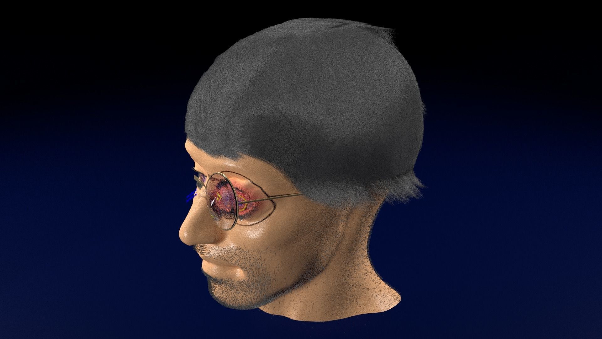 Thyroid eye lesions 3D model_78