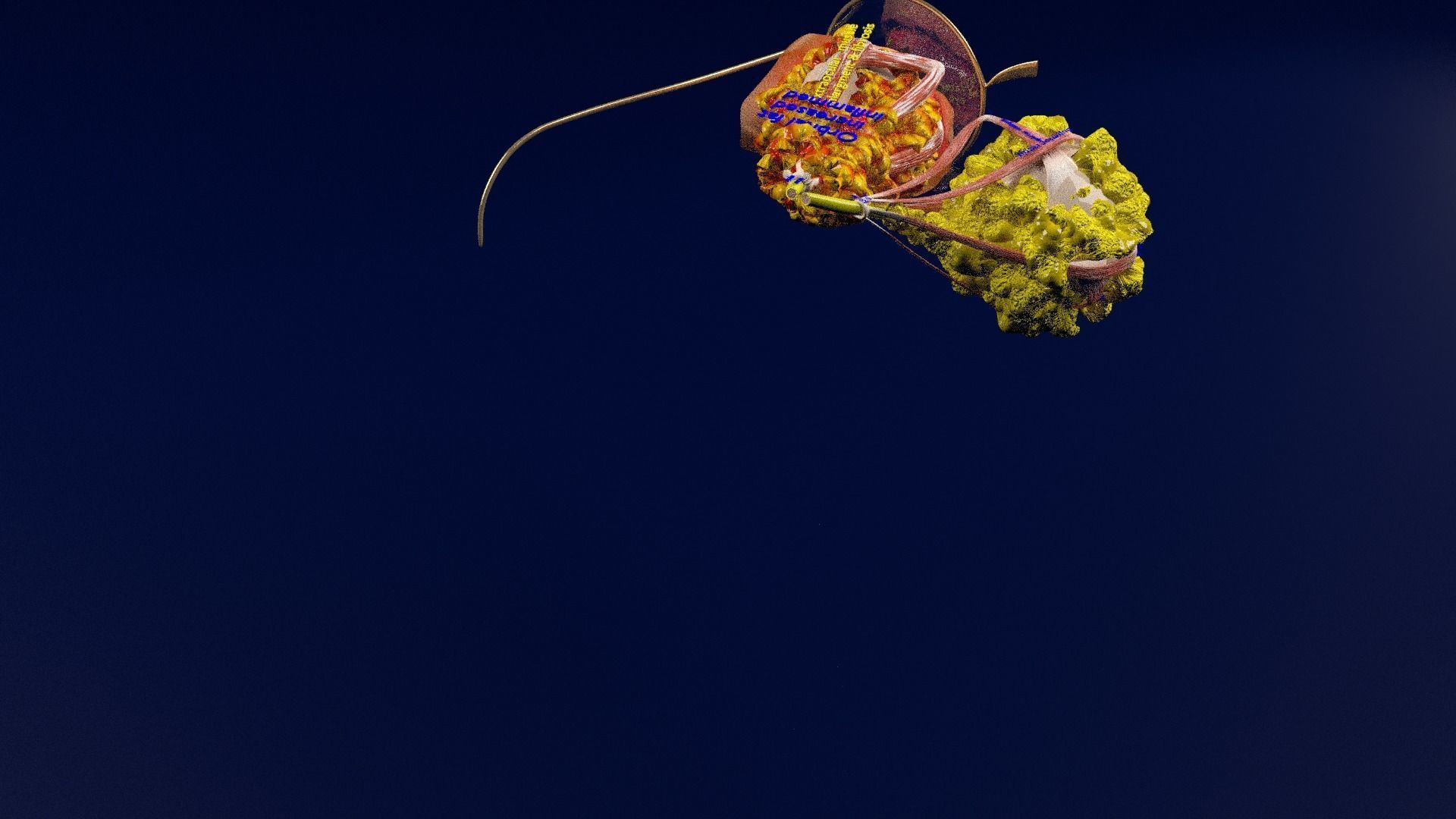 Thyroid eye lesions 3D model_61