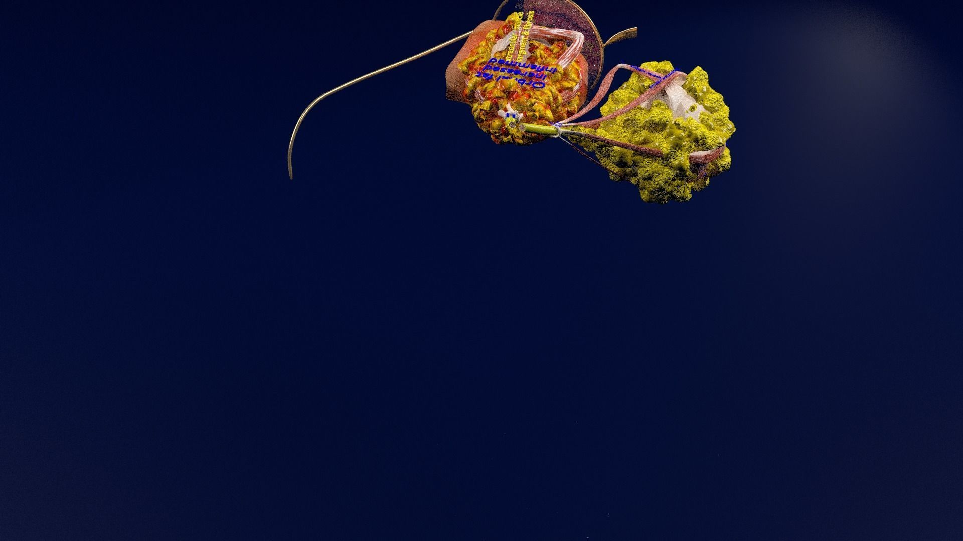 Thyroid eye lesions 3D model_110