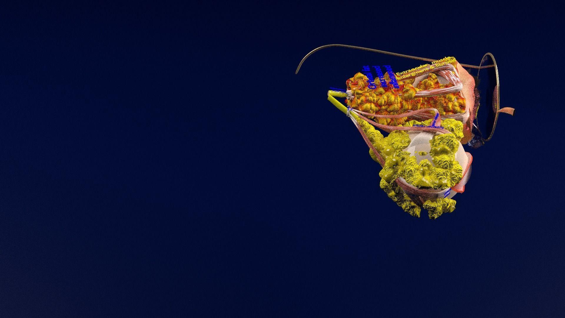 Thyroid eye lesions 3D model_36