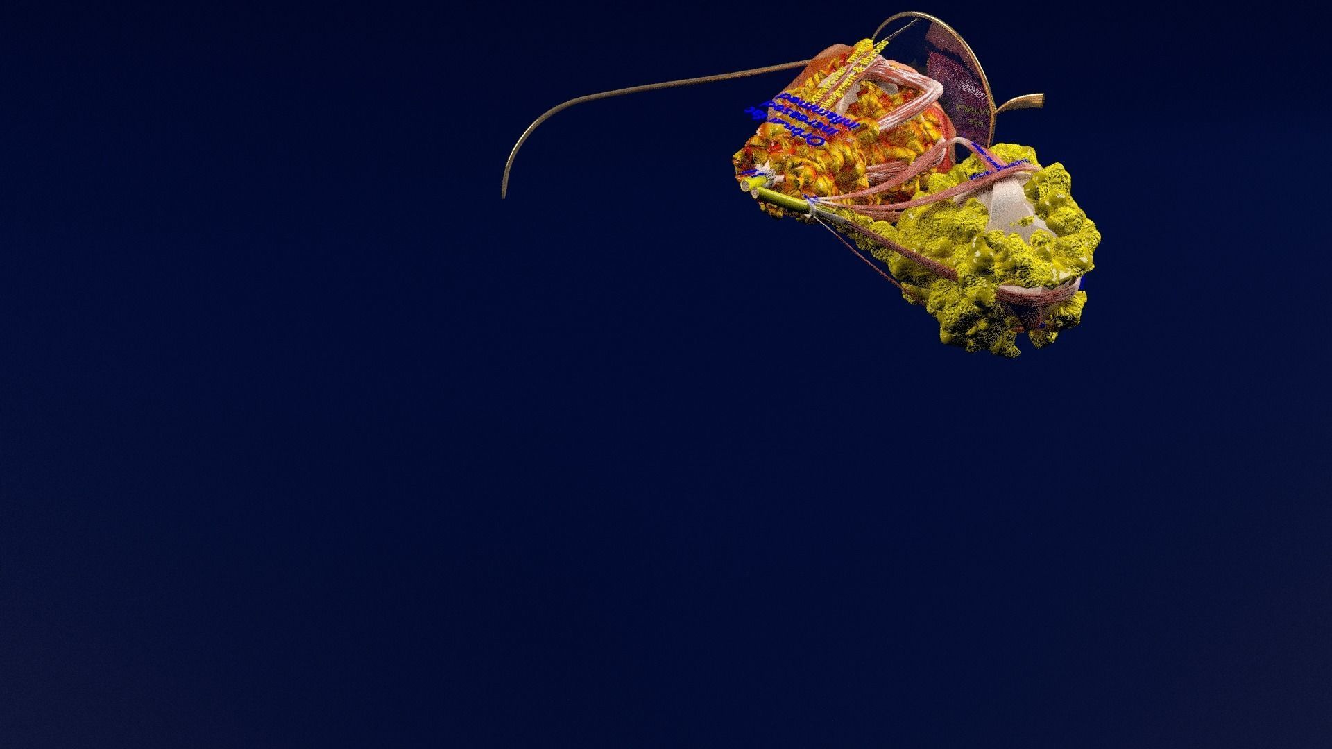 Thyroid eye lesions 3D model_29