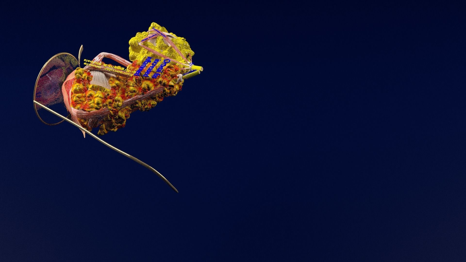 Thyroid eye lesions 3D model_64