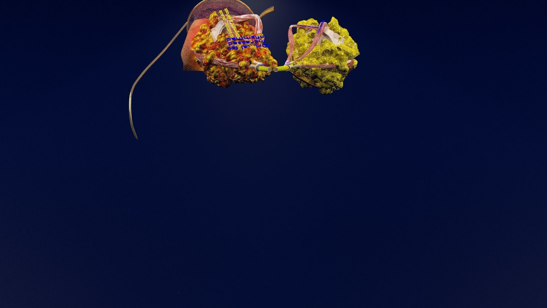 Thyroid eye lesions 3D model_112