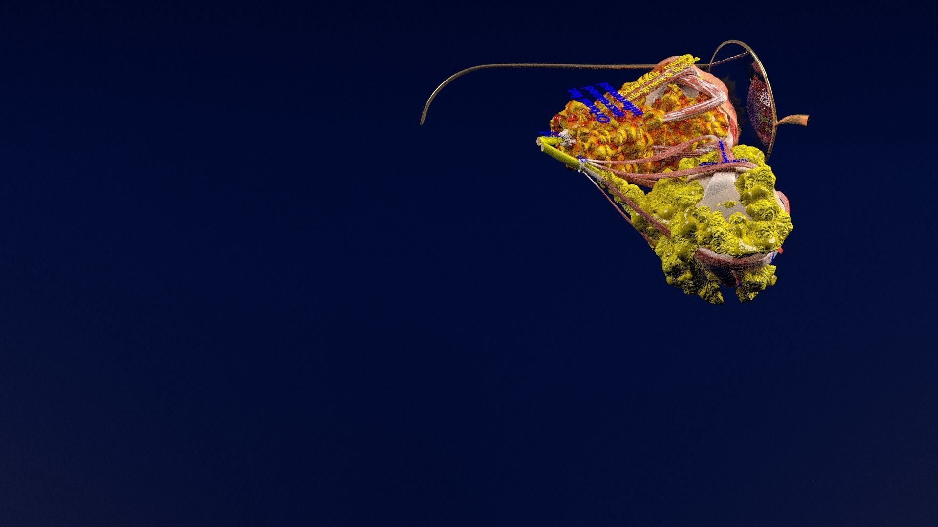 Thyroid eye lesions 3D model_42