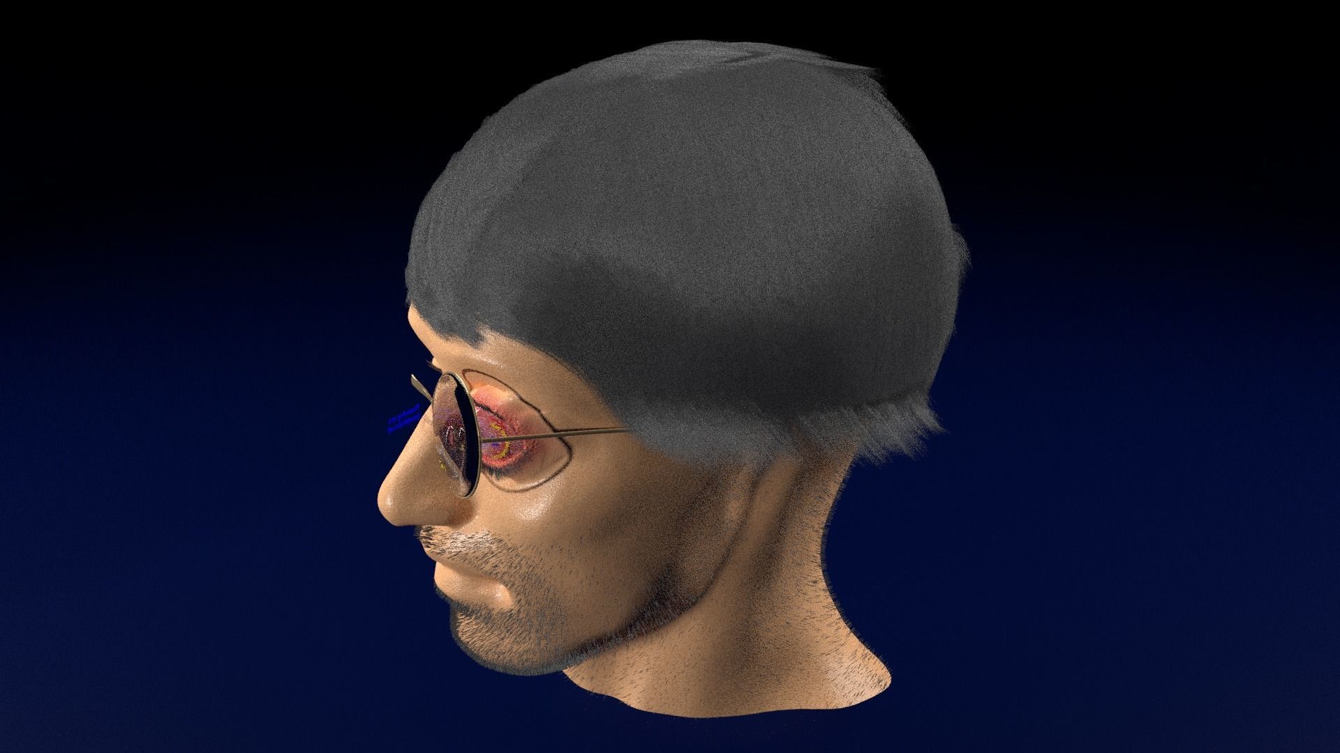 Thyroid eye lesions 3D model_116