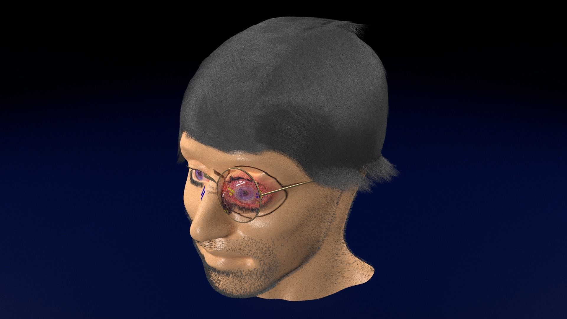 Thyroid eye lesions 3D model_85