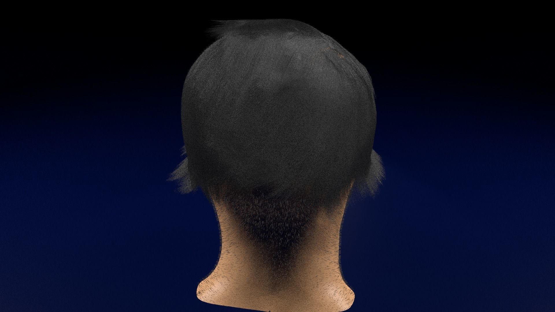 Thyroid eye lesions 3D model_100