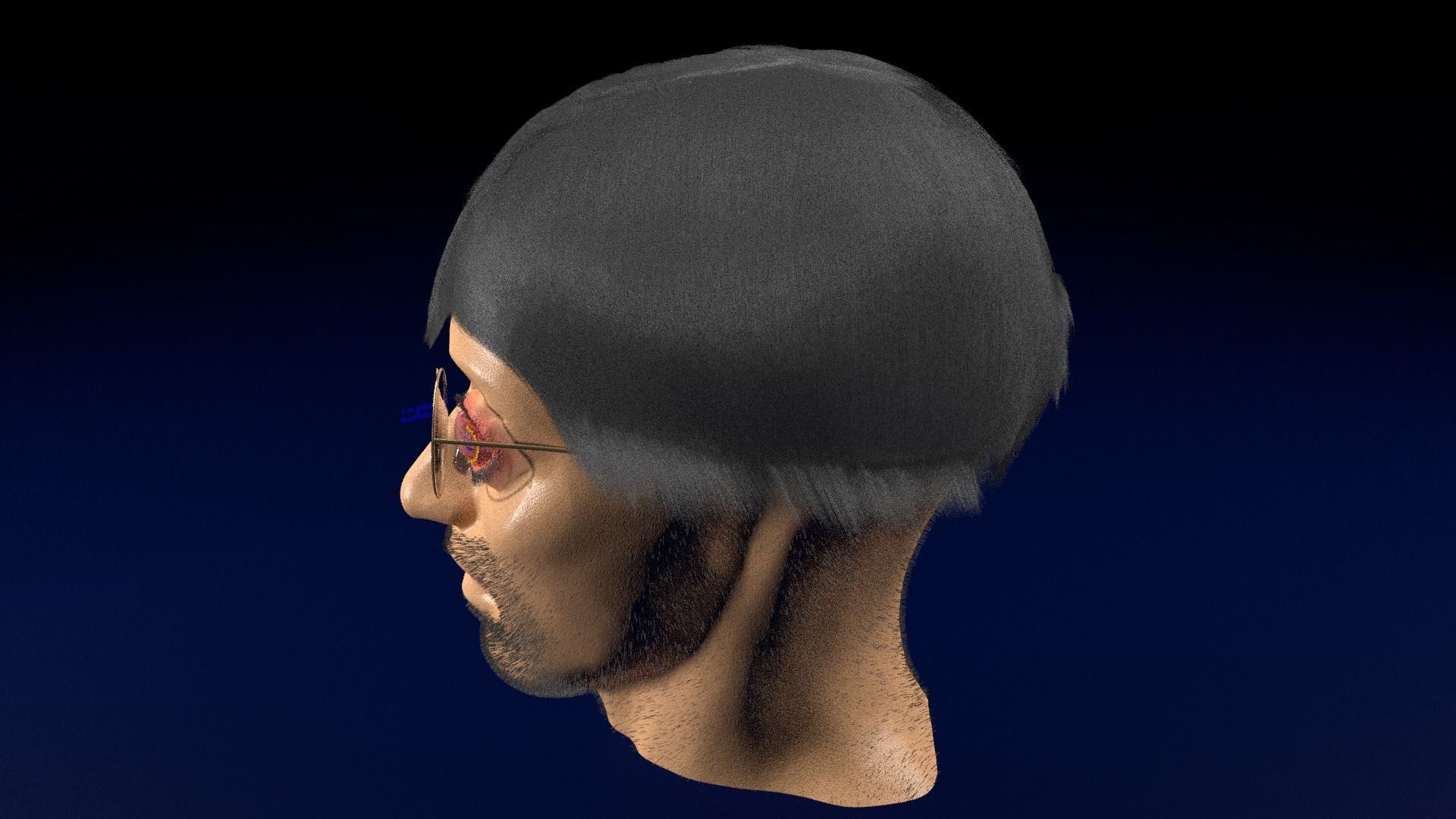 Thyroid eye lesions 3D model_123