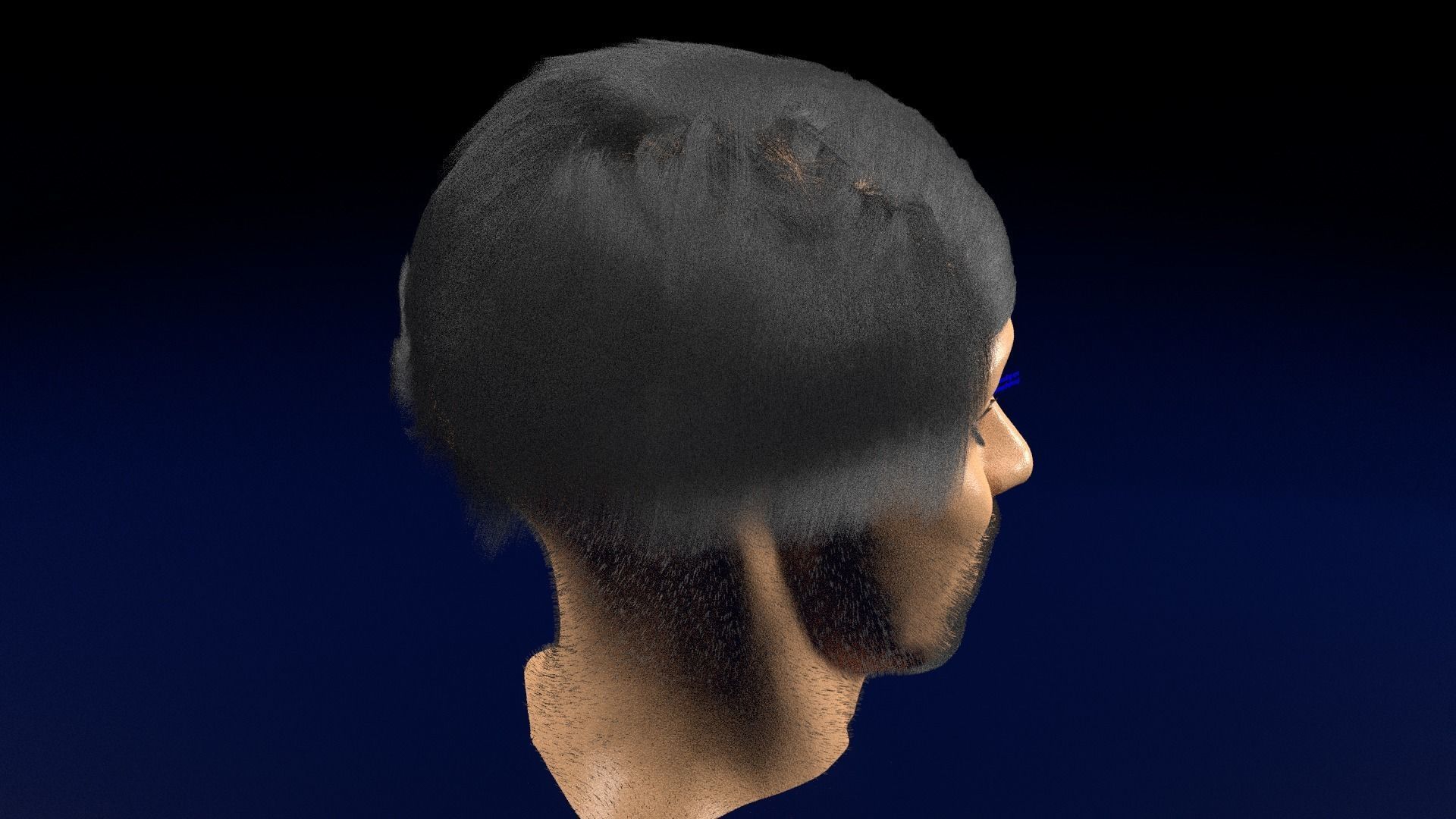 Thyroid eye lesions 3D model_75