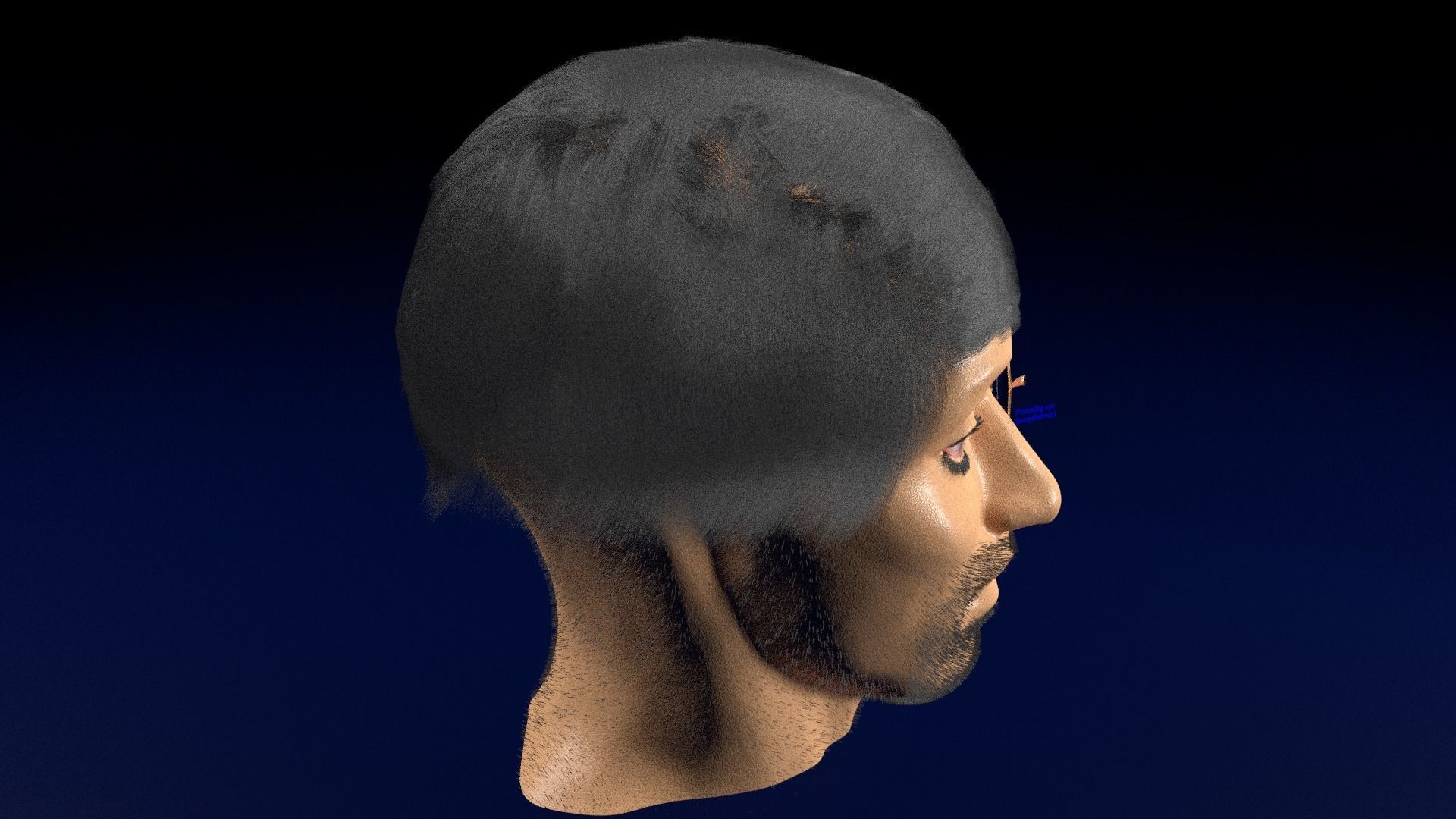 Thyroid eye lesions 3D model_92