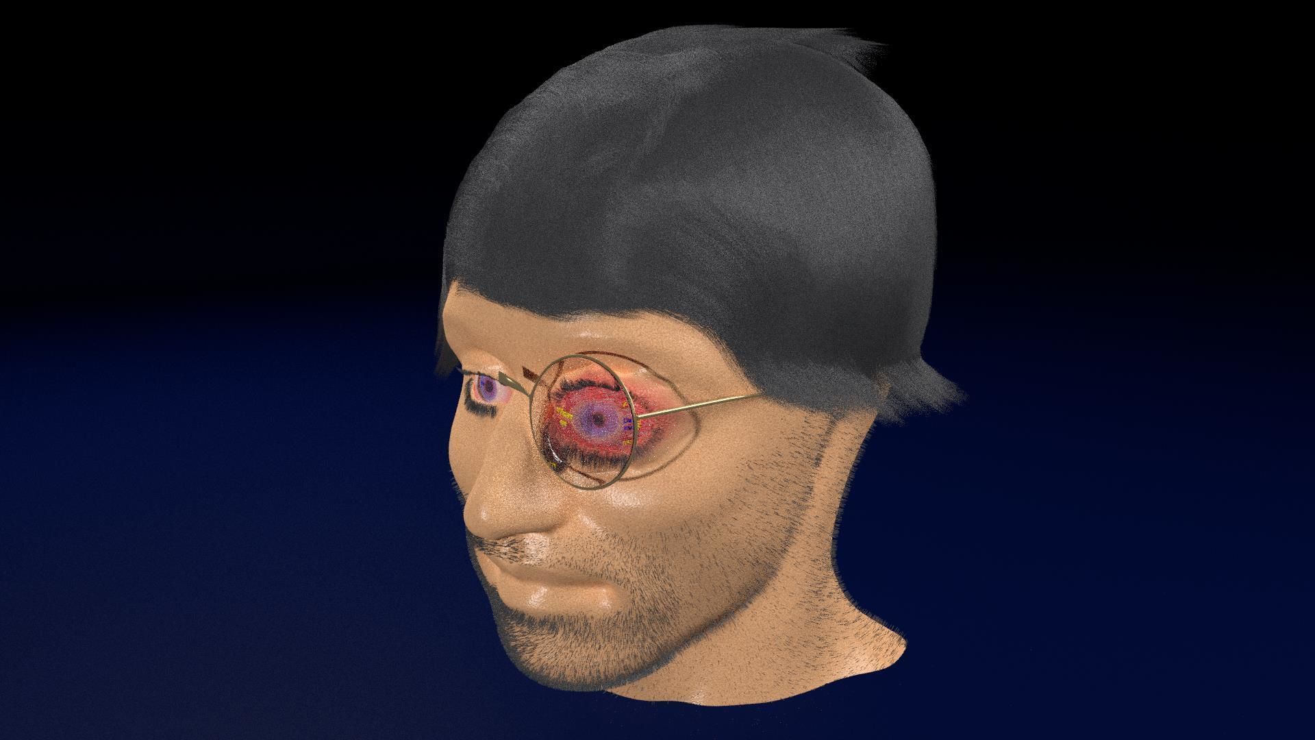 Thyroid eye lesions 3D model_22